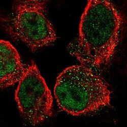 SLFN5 Antibody, Novus Biologicals 25 &mu;L; Unlabeled:Antibodies, Polyclonal