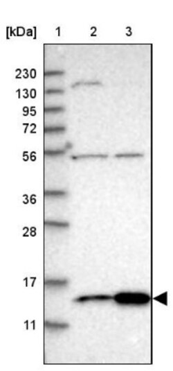 SLIRP Antibody, Novus Biologicals 0.1mL; Unlabeled:Antibodies, Polyclonal