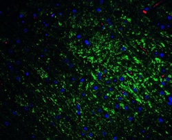SLITRK1 Antibody - BSA Free, Novus Biologicals 0.1mg; Unlabeled:Antibodies,
