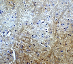 SLITRK1 Antibody - BSA Free, Novus Biologicals 0.1mg; Unlabeled:Antibodies,