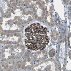 SLK Antibody, Novus Biologicals:Antibodies:Primary Antibodies
