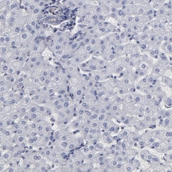 SLMAP Antibody, Novus Biologicals 0.1mL; Unlabeled:Antibodies, Polyclonal