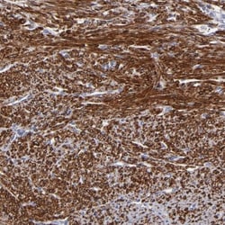 SLMAP Antibody, Novus Biologicals 0.1mL; Unlabeled:Antibodies, Polyclonal