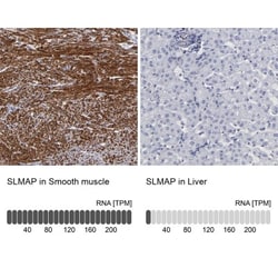 SLMAP Antibody, Novus Biologicals 0.1mL; Unlabeled:Antibodies, Polyclonal