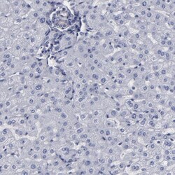 SLMAP Antibody, Novus Biologicals:Antibodies:Primary Antibodies