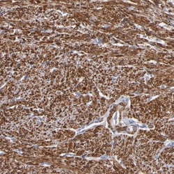 SLMAP Antibody, Novus Biologicals:Antibodies:Primary Antibodies