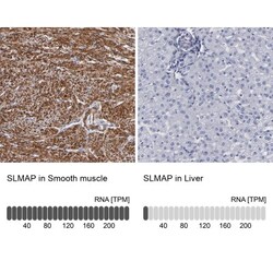 SLMAP Antibody, Novus Biologicals:Antibodies:Primary Antibodies
