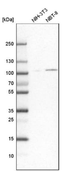 SLMAP Antibody, Novus Biologicals 0.1mL; Unlabeled:Antibodies, Polyclonal