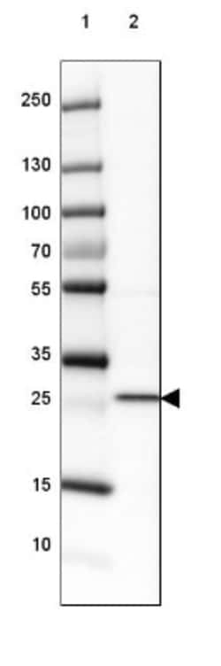 SLMO2 Antibody, Novus Biologicals 0.1mL; Unlabeled:Antibodies, Polyclonal