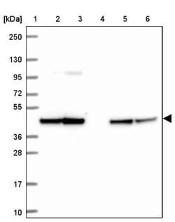 SLP-2 Antibody, Novus Biologicals 25 &mu;L, Unlabeled:Antibodies, Polyclonal