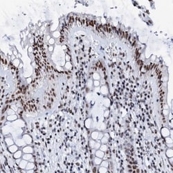 SLTM Antibody, Novus Biologicals 0.1mL; Unlabeled:Antibodies, Polyclonal