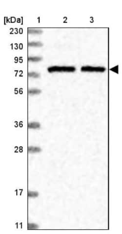 SLU7 Antibody, Novus Biologicals 25 &mu;L | Buy Online | Novus Biologicals | Fisher Scientific