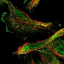 SMAGP Antibody, Novus Biologicals:Antibodies:Primary Antibodies
