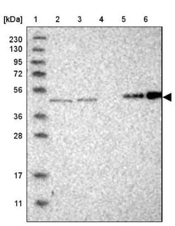 SMAP2 Antibody, Novus Biologicals:Antibodies:Primary Antibodies