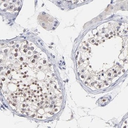 SMARCA1 Antibody, Novus Biologicals 0.1mL; Unlabeled:Antibodies, Polyclonal
