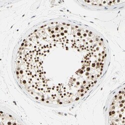 SMARCA5/SNF2H Antibody, Novus Biologicals 25 &mu;L; Unlabeled:Antibodies,