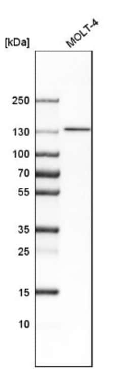 SMARCA5/SNF2H Antibody, Novus Biologicals 25 &mu;L; Unlabeled:Antibodies,