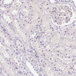 SMARCA6 Antibody, Novus Biologicals 25 &mu;L, Unlabeled:Antibodies, Polyclonal