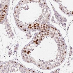 SMARCA6 Antibody, Novus Biologicals 25 &mu;L, Unlabeled:Antibodies, Polyclonal