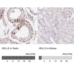 SMARCA6 Antibody, Novus Biologicals 25 &mu;L, Unlabeled:Antibodies, Polyclonal