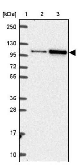 SMARCA6 Antibody, Novus Biologicals 25 &mu;L, Unlabeled:Antibodies, Polyclonal