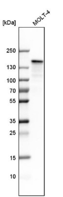 SMARCAD1 Antibody, Novus Biologicals 0.1mL; Unlabeled:Antibodies, Polyclonal