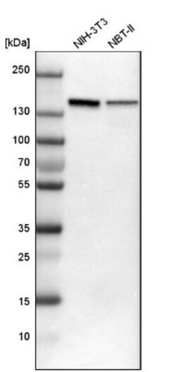 SMARCAD1 Antibody, Novus Biologicals 0.1mL; Unlabeled:Antibodies, Polyclonal
