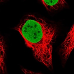 SMARCC1 Antibody, Novus Biologicals 25 &mu;L; Unlabeled:Antibodies, Polyclonal