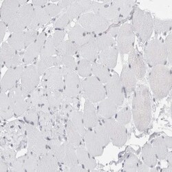 SMARCC1 Antibody, Novus Biologicals 25 &mu;L; Unlabeled:Antibodies, Polyclonal