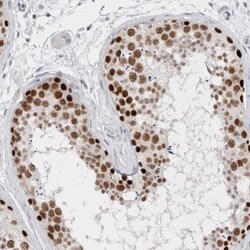 SMARCC1 Antibody, Novus Biologicals 25 &mu;L; Unlabeled:Antibodies, Polyclonal