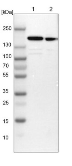 SMARCC1 Antibody, Novus Biologicals 25 &mu;L; Unlabeled:Antibodies, Polyclonal