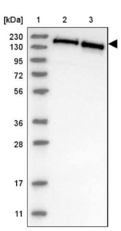 SMARCC2/BAF170 Antibody, Novus Biologicals:Antibodies:Primary Antibodies