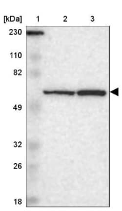 SMARCD1 Antibody, Novus Biologicals:Antibodies:Primary Antibodies