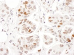 SMC1 Antibody, Novus Biologicals 0.1mg; Unlabeled:Antibodies, Polyclonal