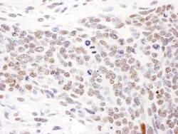 SMC1 Antibody, Novus Biologicals 0.1mg; Unlabeled:Antibodies, Polyclonal