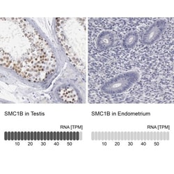 SMC1L2 Antibody, Novus Biologicals 25 &mu;L, Unconjugated:Antibodies, Polyclonal