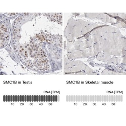 SMC1L2 Antibody, Novus Biologicals 25 &mu;L, Unconjugated:Antibodies, Polyclonal