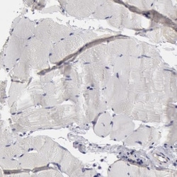 SMC1L2 Antibody, Novus Biologicals 25 &mu;L, Unconjugated:Antibodies, Polyclonal