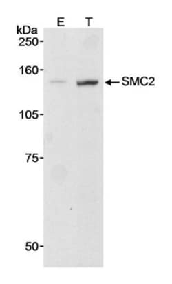 SMC2 Antibody, Novus Biologicals 0.1mg; Unlabeled:Antibodies, Polyclonal