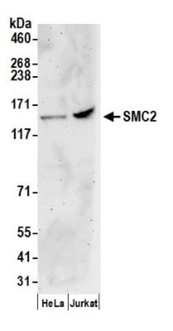 SMC2 Antibody, Novus Biologicals 0.1mg; Unlabeled:Antibodies, Polyclonal