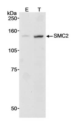 SMC2 Antibody, Novus Biologicals 0.1mg; Unlabeled:Antibodies, Polyclonal