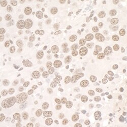 SMC3 Antibody, Novus Biologicals 0.1mL; Unlabeled:Antibodies, Polyclonal
