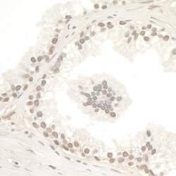 SMC3 Antibody, Novus Biologicals 0.1mL; Unlabeled:Antibodies, Polyclonal
