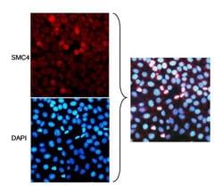 SMC4 Antibody, Novus Biologicals 0.1mg; Unlabeled:Antibodies, Polyclonal