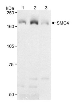 SMC4 Antibody, Novus Biologicals 0.1mg; Unlabeled:Antibodies, Polyclonal