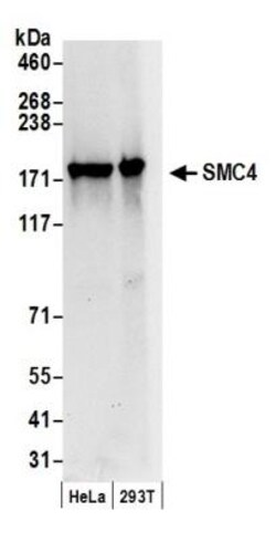 SMC4 Antibody, Novus Biologicals 0.1mg; Unlabeled:Antibodies, Polyclonal