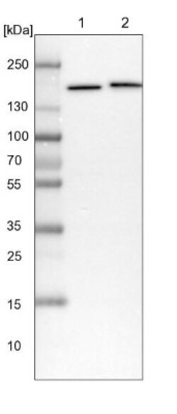 TATDN1 Antibody, Novus Biologicals:Antibodies:Primary Antibodies
