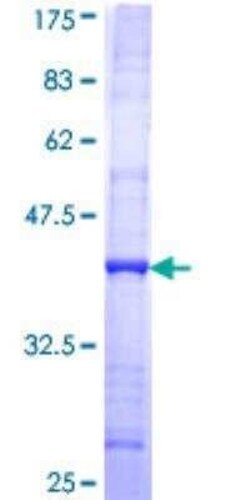 Novus Biologicals Recombinant Human SMC5 GST (N-Term) Protein 10 &mu;g | Buy Online | Novus Biologicals&trade; | Fisher Scientific