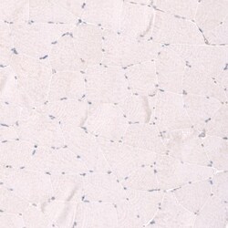 SMC6L1 Antibody, Novus Biologicals 25 &mu;L, Unlabeled:Antibodies, Polyclonal