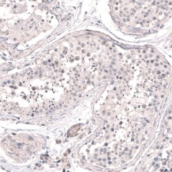 SMC6L1 Antibody, Novus Biologicals 25 &mu;L, Unlabeled:Antibodies, Polyclonal